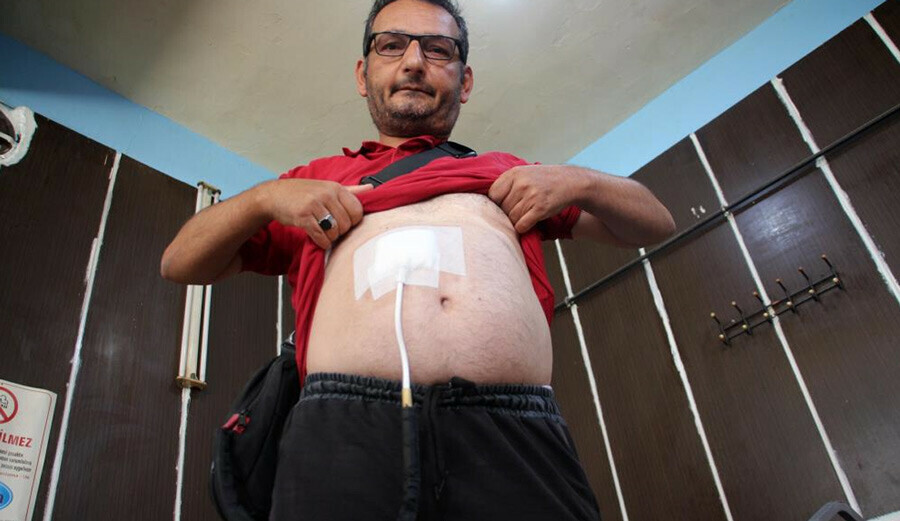 Kalbini 'elinde' taşıyor… Para çantası zannedip yan kesicilere kaptırmak en büyük korkusu